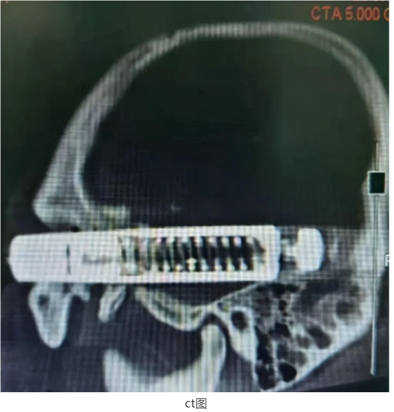 1611283469910356.png 圖片.png